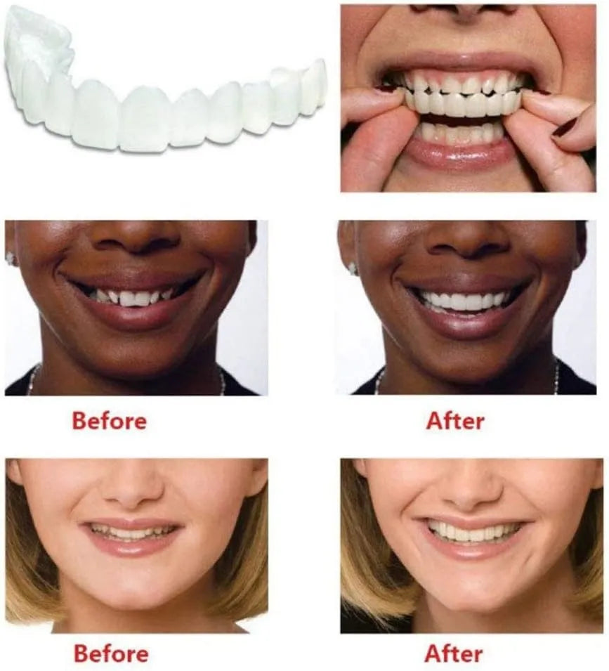 Comfort Fit Flexible Teeth || أسنان مرنة مريحة