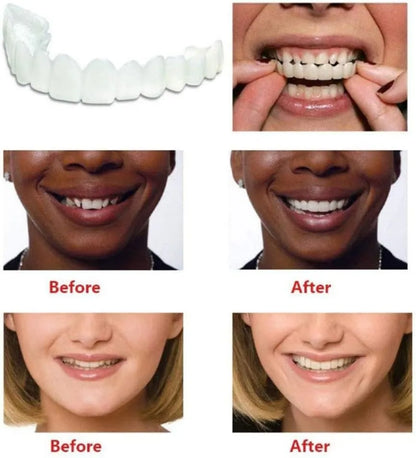 Comfort Fit Flexible Teeth || أسنان مرنة مريحة